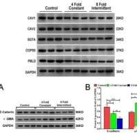 Western Blot(蛋白质免疫印迹)