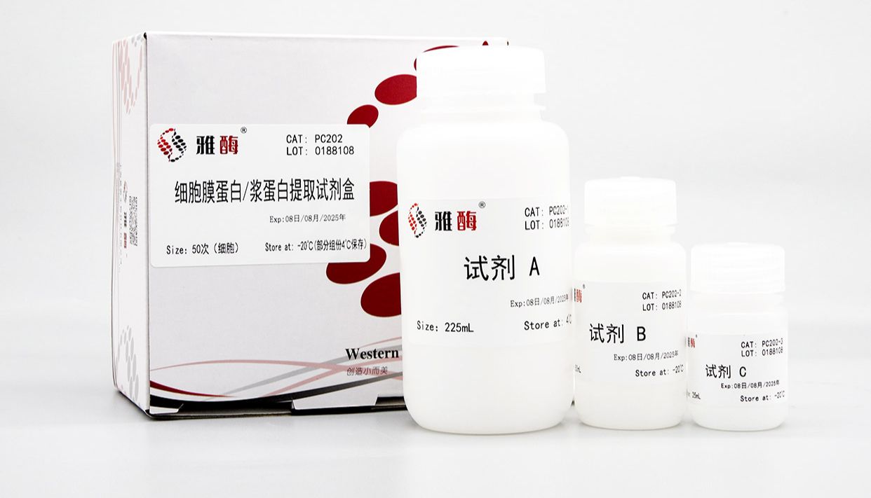 膜蛋白WB实验小贴士