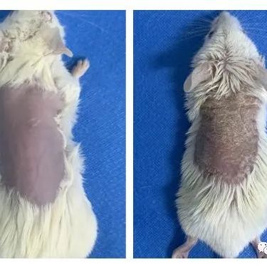 小鼠银屑病模型