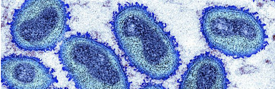 RD如何应对猴痘？