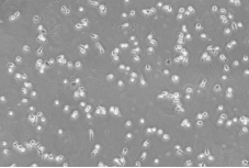 人外周血来源巨噬细胞扩增培养实验方法的构建