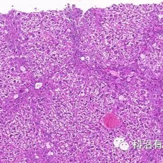 大鼠肝纤维化模型