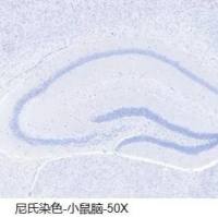 甲苯胺蓝染色