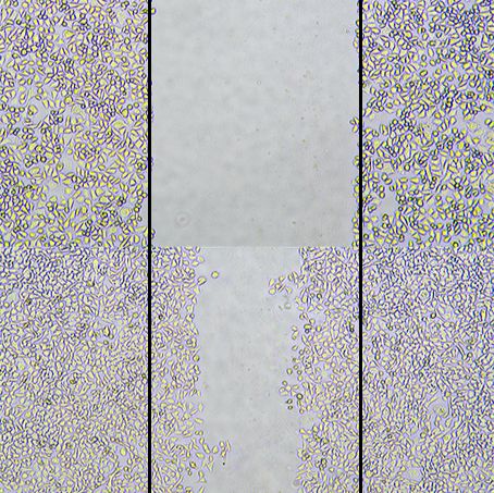 细胞划痕实验
