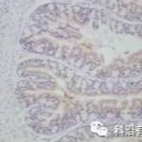 免疫组化(IHC/ICC)