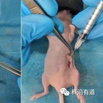 裸鼠卵巢癌原位移植瘤模型