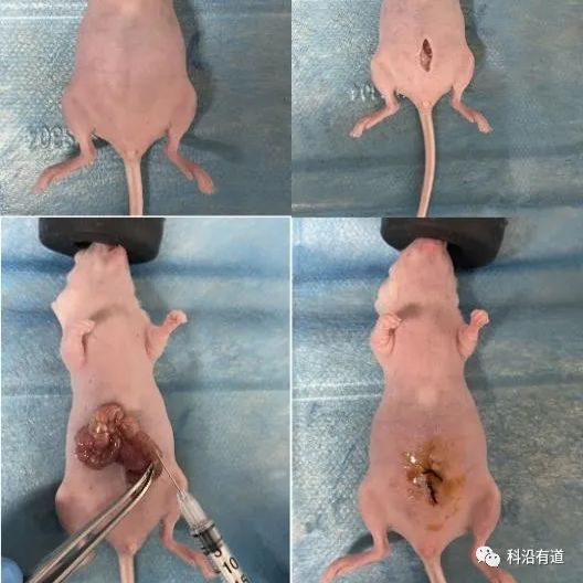 裸鼠结肠癌原位移植瘤模型