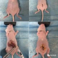 裸鼠结肠癌原位移植瘤模型