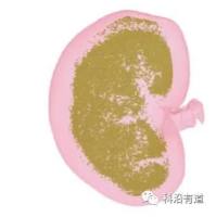 大鼠肾结石模型