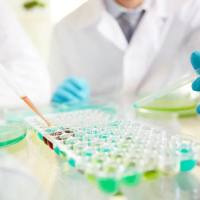 Label free蛋白质谱