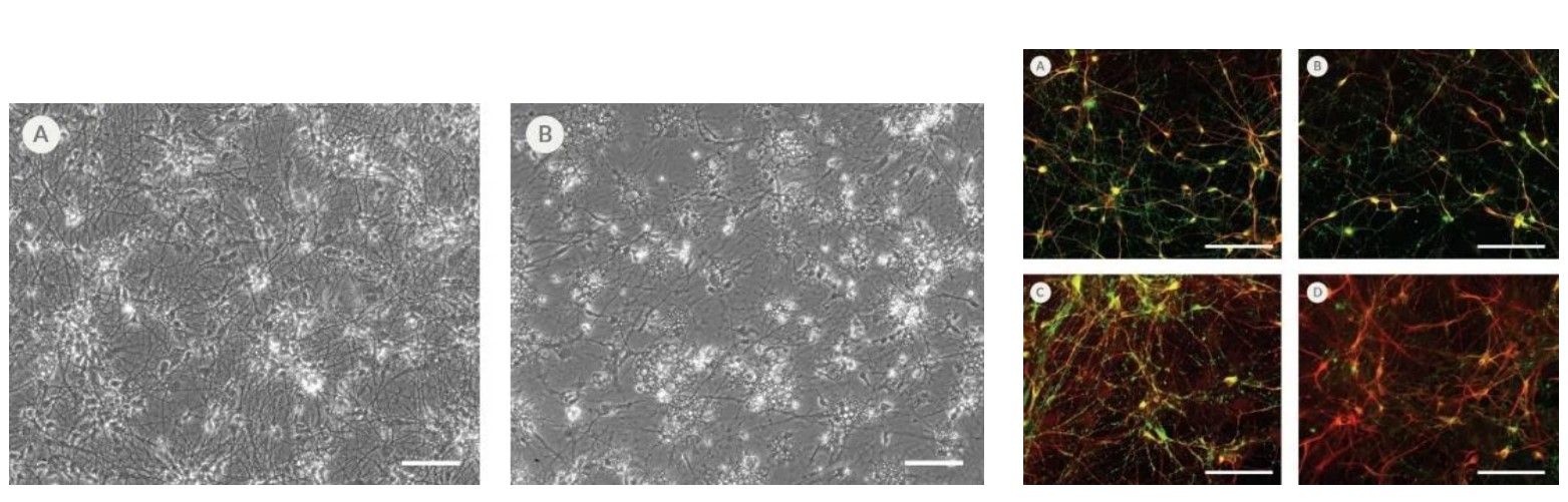 BrainPhys™ hPSC神经元试剂盒