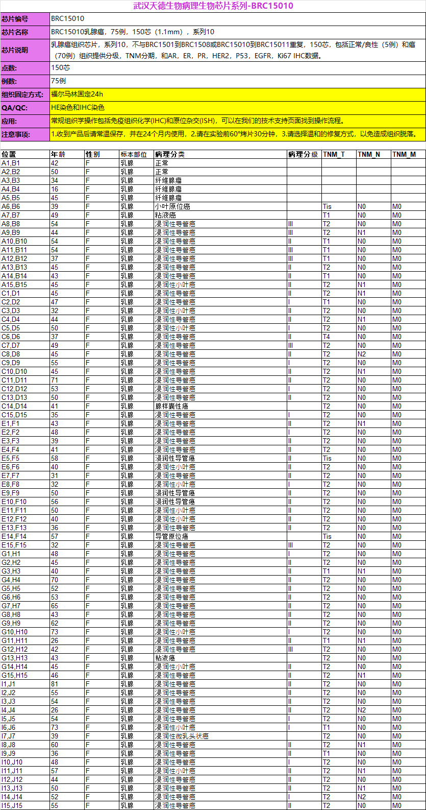 乳腺癌,75例,150芯(1.1mm),系列10