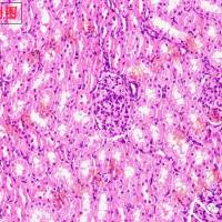 动物造模——大鼠非酒精性脂肪肝模型