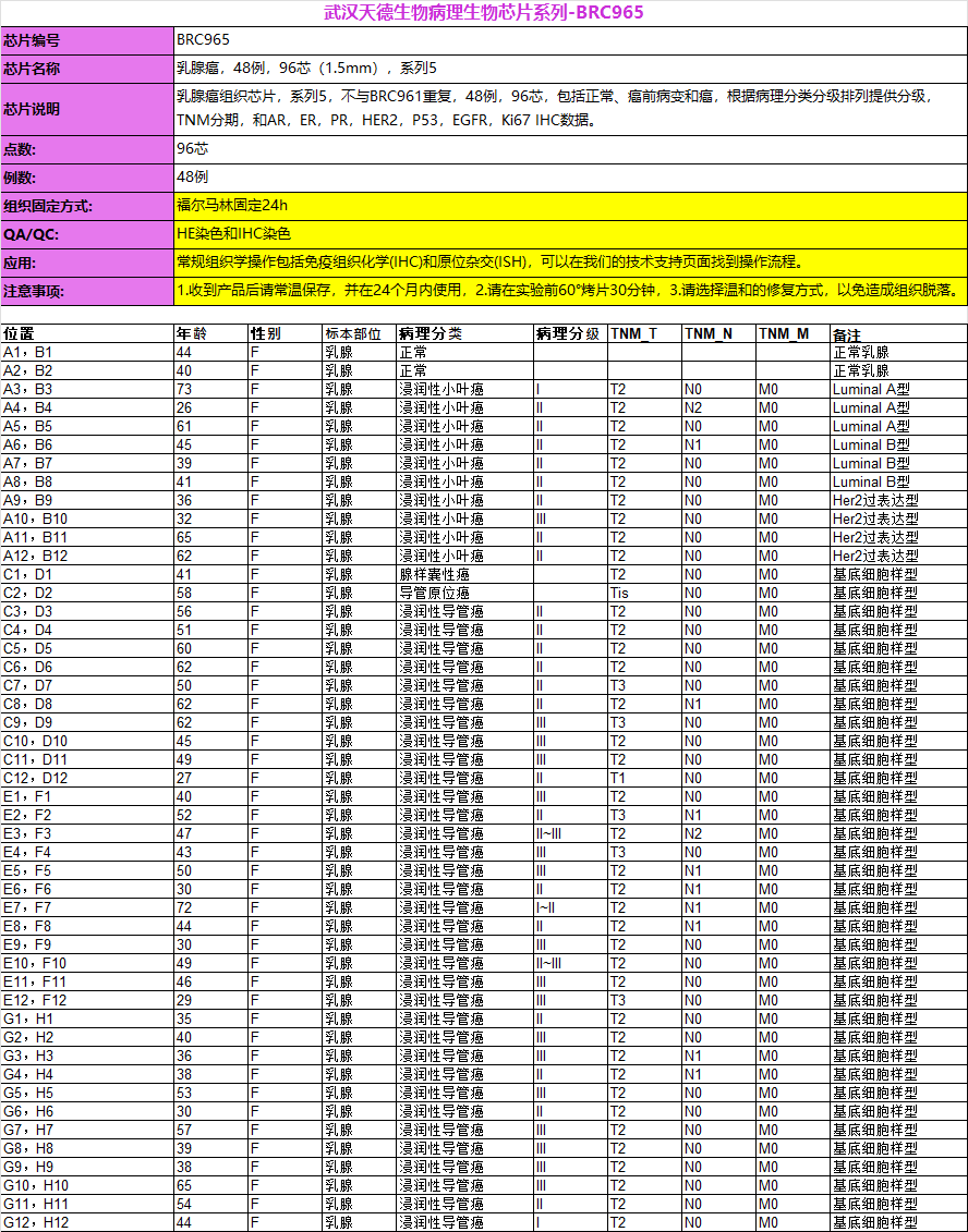 乳腺癌，48例，96芯（1.5mm），系列5
