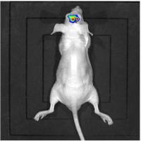 裸鼠脑胶质瘤原位移植模型