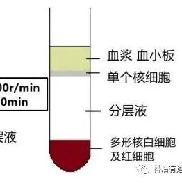 密度梯度离心法提取PBMC简介