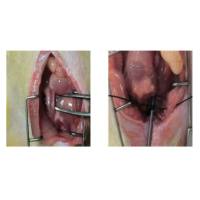 动物造模丨大鼠尿道狭窄模型