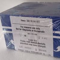 人氧化低密度脂蛋白(OxLDL)ELISA试剂盒