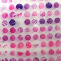 乳腺癌及自体淋巴结转移，48例，96芯（1.5mm）