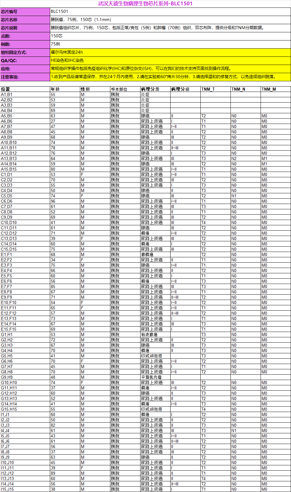 膀胱癌,75例,150芯(1.1mm)