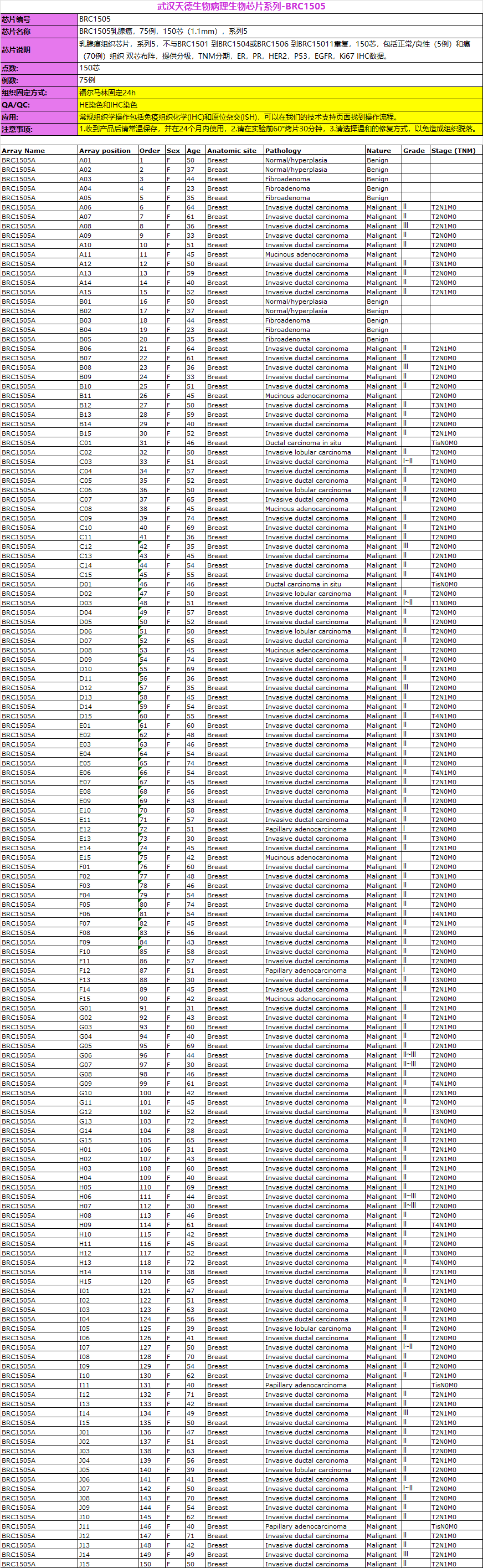 乳腺组织芯片BRC1505