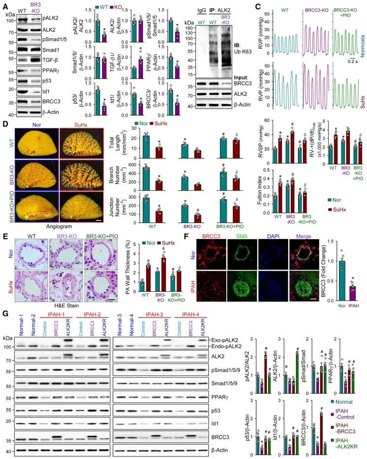 扬州大学附属医院团队发现去泛素化酶BRCC3调控肺血管重构及肺动脉高压发生发展过程