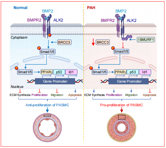 扬州大学附属医院团队发现去泛素化酶BRCC3调控肺血管重构及肺动脉高压发生发展过程