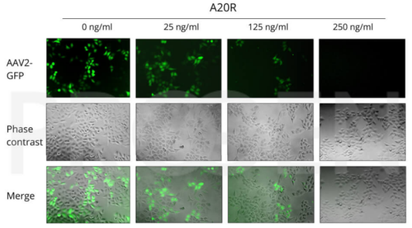抗AAV2,A20R,小鼠重组抗体/anti-AAV2, A20R, mouse recombinant ab促销 抗AAV2,A20R,小鼠重组抗体/anti-AAV2, A20R, mouse recombinant ab促销