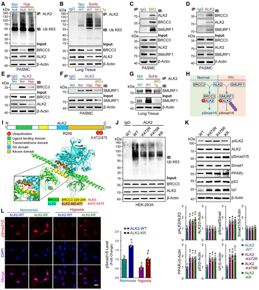 扬州大学附属医院团队发现去泛素化酶BRCC3调控肺血管重构及肺动脉高压发生发展过程
