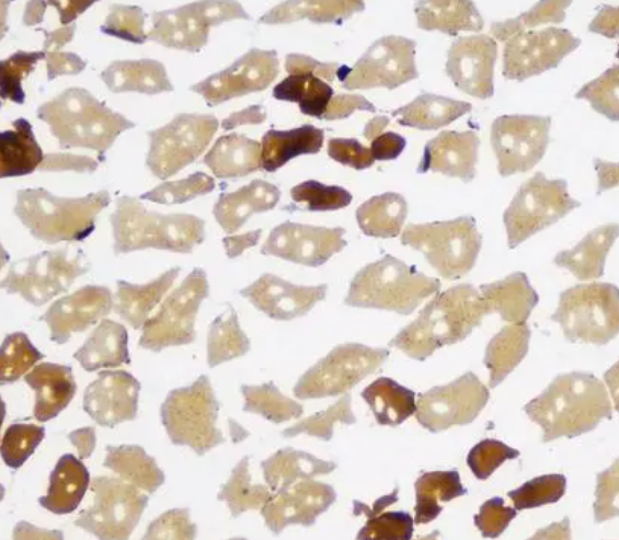 ATP酶染色(实验检测服务)