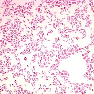 快速革兰氏染色（实验检测）