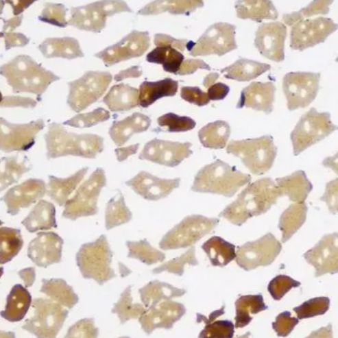 ATP酶染色(实验检测服务)