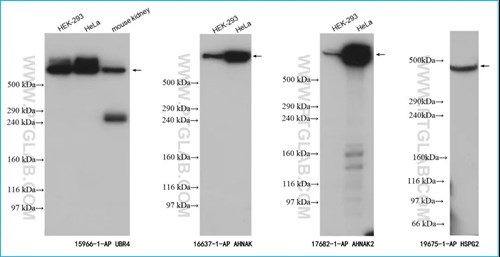 Western Blot大分子蛋白指南