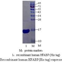心型脂肪酸结合蛋白(H-FABP）抗原 ，H-FABP抗原，天然或重组