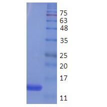 胱抑素C抗原 ， Cystatin C，Cys C蛋白
