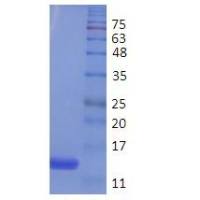 胱抑素C抗原 , Cystatin C,Cys C蛋白