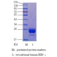 人附睾分泌蛋白4,Human epididymis protein 4,HE4抗原