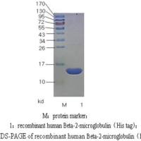 β2-微球蛋白抗原（β2-MG），β2-微球蛋白（β2-MG）,α1-微球蛋白抗原（α1-MG）  天然或重组