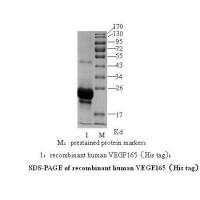 血管内皮生长因子抗体/VEGF-McAb