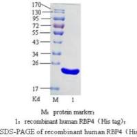 视黄醇结合蛋白4 ( RBP4 )，RBP4抗原