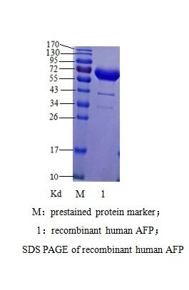 甲胎蛋白（AFP）抗原；甲胎蛋白；AFP抗原  