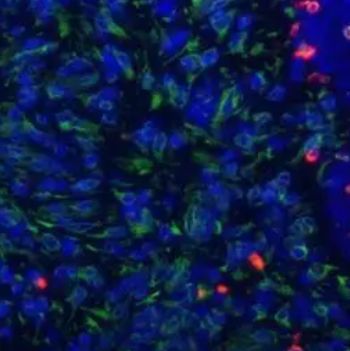 免疫荧光单标双色染色（实验检测）