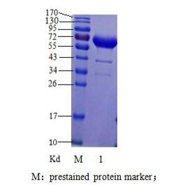 甲胎蛋白（AFP）抗原；甲胎蛋白；AFP抗原  