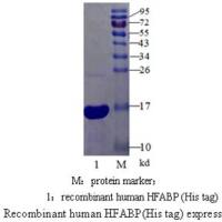 心型脂肪酸结合蛋白(H-FABP)单克隆抗体；心型脂肪酸结合蛋白抗体；H-FABP抗体