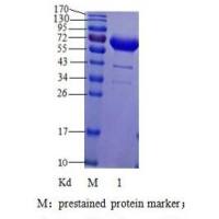甲胎蛋白单克隆抗体，AFP-McAb，甲胎蛋白抗体，AFP抗体