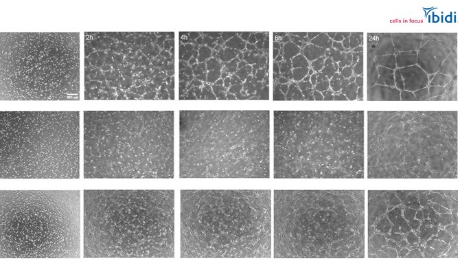 血管生成protocol|利用层粘连蛋白-胶原蛋白进行成管实验