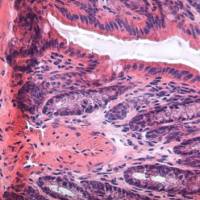 Dextran sulfate sodium,DSS, 葡聚糖硫酸钠,结肠炎模型诱导