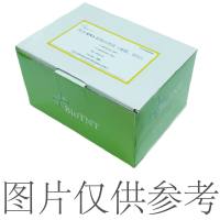 大容量外泌体分离试剂盒（尿液、培养上清）