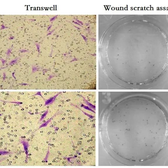 细胞迁移与侵袭实验