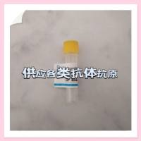 a1胰蛋-白酶（a1-AT）抗原